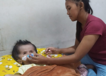 Bayi Penderita Hidrosefalus di Tangsel Butuh Pertolongan Segera