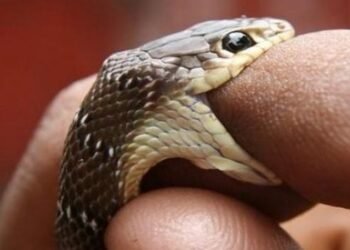 Digigit Ular Kobra, Pria di Tangsel Alami Panas seperti Terbakar